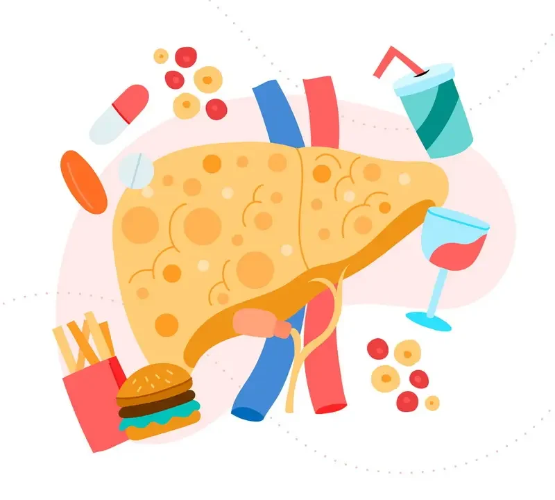 کبد چرب: علائم، دلایل، پیشگیری و درمان